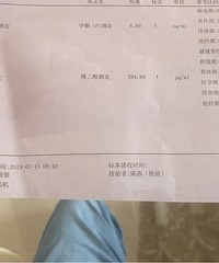 ��ͪ�Ͳ�8.69����û�и���һ����С��飿