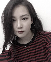 歪七八扭的牙齿矫正后,脸变小了,拍照也敢露齿笑