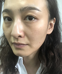 γԵҽû뵽2ܺƤϸ壬ɫҲ