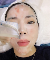 美白是终生事业!做这个医美7天后,皮肤变得细腻