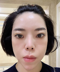 美白是终生事业!做这个医美7天后,皮肤变得细腻