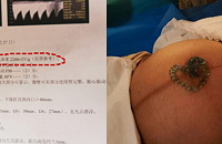 ���ǵ��ģ���37�ܵ��һ��˸���33�ܡ��ı���