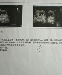 ������ȫ����ϸ�Ĳ������̣����ֱ����ܽ��������������ͼ