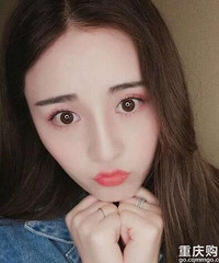 大鼻头变小翘鼻后,鼻型好看,整张脸变得精致小巧
