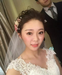 模特为了工作,做了鼻子和自体脂肪填充