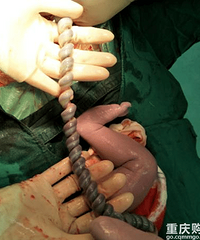 6�������Ťת����̥ͣ����֪����ʲôԭ����ɵ���