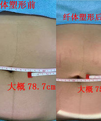 做了这个腰围小了3厘米