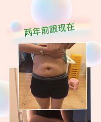 一张图告诉你,为啥要管住嘴,迈开腿!