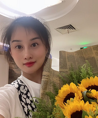 时隔两年再次隆鼻,术后半个月侧面鼻子高度很自然