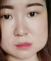 拔智齿经历,心理阴影极大