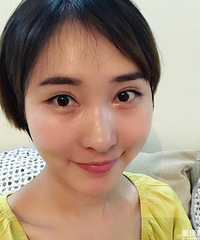 山根低看着不秀气,隆鼻两个月就恢复得自然,变得更有女人味