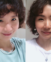 ��������Ƥ�ɳڣ�ҽ��˵��üЧ�����ã��������