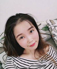 肿眼泡变大双眼皮后,感觉像变了一个人