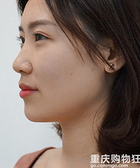 趼û仯󲻽СһȦҲ