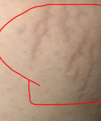 怀孕4个月,躲不掉的妊娠纹还是来了,这些“边缘地带”常被忽略