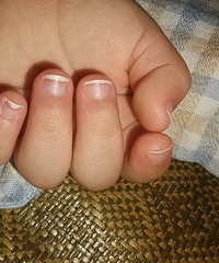 �޶�ָ�׼״�Խ��Խ�̣����������ı�����