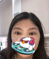 (ʵʱ����)˫��Ƥ���۴�����ȫ����