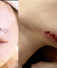 °ͷ15룬˿Ѫܣ˻Ǽұ