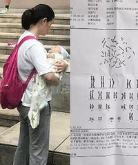 做试管却生下唐氏儿