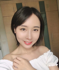 耳软骨隆鼻小综合,恢复得还不错哦~