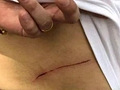 嚇!奈良鹿又傷人