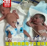 74岁老太生双胞胎