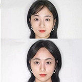 改善高低眉的好方法