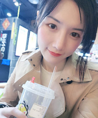 塌鼻子显得脸大!隆鼻后,小翘鼻好看精致,朋友都说我手术很成功