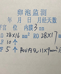 重医附二院排卵监测,66一次