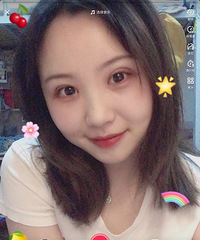 想分享一下我做了一个月的双眼皮,感觉这次是赌对了