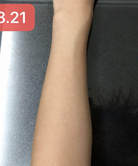 这款身体乳搭配美白精华,用了半个月白了一个度,不信来看