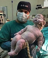 这个新生儿生下来17斤多