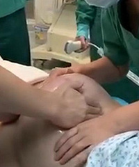1分钟剖腹变顺产