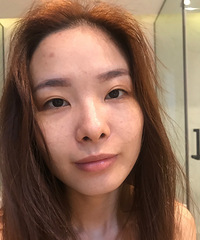 婚前做个深层清洁+美白管理真是棒棒哒!