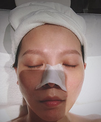 快速去黑头的方法