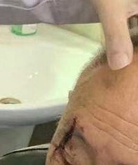 爸爸被轻轨员工撞伤,连句道歉都没