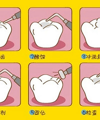睡前吃零食宝宝容易长蛀牙,这样做能让口腔更健康