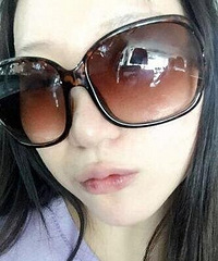 玻尿酸丰唇15天,性感的嘟嘟唇很喜欢