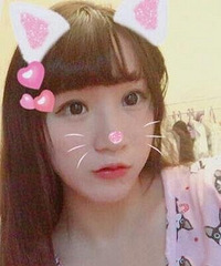 玻尿酸丰唇15天,性感的嘟嘟唇很喜欢