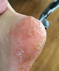 ʪأΪʹüҩ࣬ëд˳