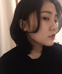 玻尿酸全脸填充后,起码年轻了5岁