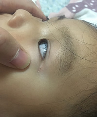 �����۽�ˤ�ˣ�������������С��̺ۣ���ʲôȥ���취