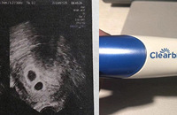 ����3�̩꣬���Թ�ʧ�ܣ��������Թܻ���˫��̥