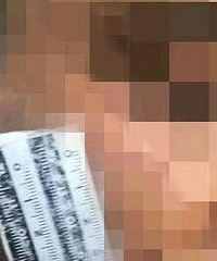 男子借20元忘还,被咬掉一半耳朵