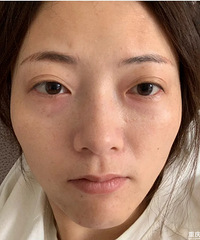 熬夜也不怕黑眼圈和眼袋严重了