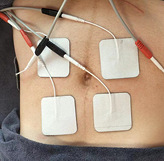 ���˺��Ӻ��������ָ�