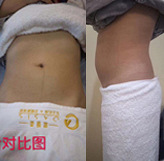 ����һ�ζ�������С��