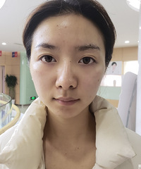 跟着购物狂抢福利!花38元不仅淡化了黑眼圈,还有紧致效果