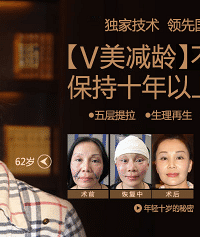 V美减龄面部提升瞬间重现年轻
