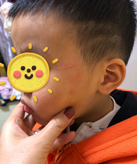 娃儿被婆子妈打了一耳光,脸上看到有明显的手指印